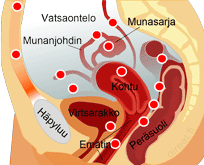 Endometrioosi - punaiset pisteet kuvaavat endometrioosipesäkkeiden yleisiä paikkoja - alkuperäisen kuvan tekijä: Tsaitgaist (käyttäjätunnus wikipediassa).