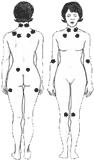 Fibromyalgian kipupisteet
