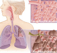 Keuhkoahtaumatauti