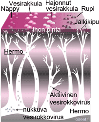 Vyöruusun ihottuman vaiheet - tauti alkaa vasemmasta reunasta ja päättyy oikeaan reunaan.